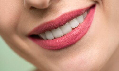 Alimenti da evitare per una corretta igiene orale